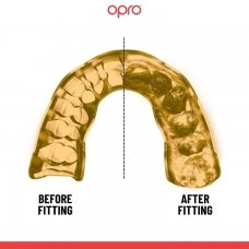 "OPRO" dantų apsauga Instant Custom Single Colour - White/Gold