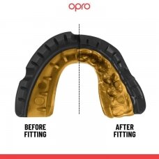 "OPRO" dantų apsauga turintiems breketus Self-Fit Gold Braces - Black/Gold