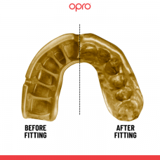 "OPRO" dantų apsauga vaikams Self-Fit Gold - Black/Gold