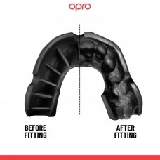 "OPRO" dantų apsauga Self-Fit Bronze - Black