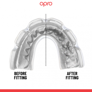 "OPRO" dantų apsauga turintiems breketus Instant Custom Braces Single Colour - Black/White 1