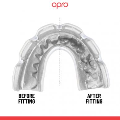 "OPRO" dantų apsauga turintiems breketus Instant Custom Braces-Fit Single Colour - Black/White 1