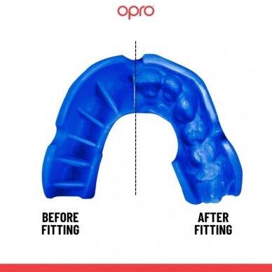 "OPRO" dantų apsauga vaikams Self-Fit Bronze - Blue 1