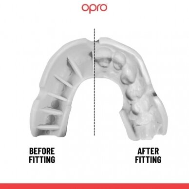"OPRO" dantų apsauga vaikams Self-Fit Bronze - White 1