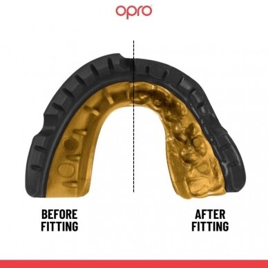 "OPRO" dantų apsauga turintiems breketus Self-Fit Gold Braces - Black/Gold 1