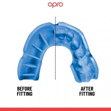 "OPRO" dantų apsauga vaikams Self-Fit Silver - Light Blue 1