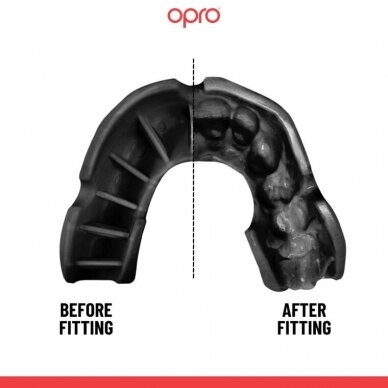 "OPRO" dantų apsauga Self-Fit Bronze - Black 1