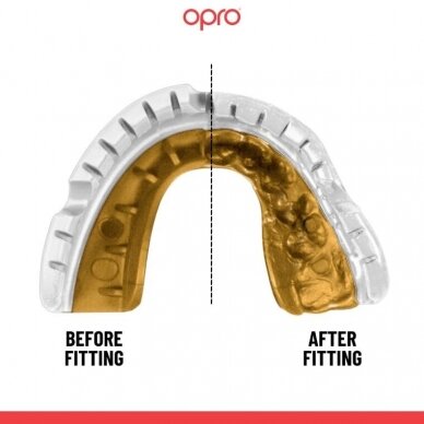 "OPRO" dantų apsauga turintiems breketus Self-Fit Gold Braces - White/Gold 1